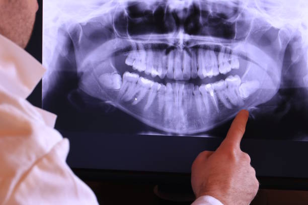 Best Emergency Care for Gum Disease in Enoch, UT